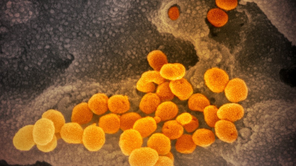 Laboratory cell culture under study — the living cells a stem cell chip miniaturises and analyses on a slide; a Panacea Bio Chem technology brief by Bogdan Dicoias